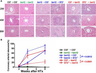 Allograft or Recipient ST2 Deficiency Oppositely Affected Cardiac Allograft Vasculopathy via Differentially Altering Immune Cells Infiltration